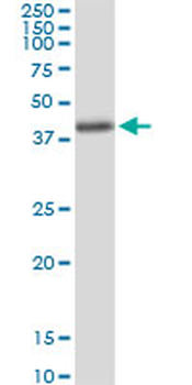 AMT MaxPab rabbit polyclonal antibody (D01)