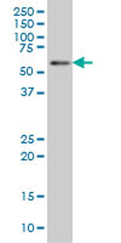 BIN1 monoclonal antibody (M01), clone 1H1
