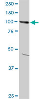 AMPD2 monoclonal antibody (M09), clone 6A8