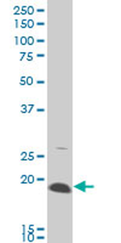AMELX monoclonal antibody (M03A), clone 3B5