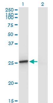 AMELX monoclonal antibody (M02A), clone 5B2