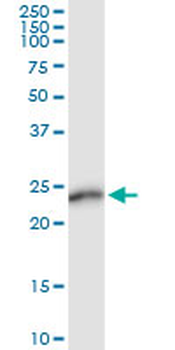 AMELX MaxPab rabbit polyclonal antibody (D01)