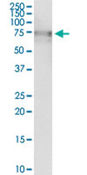 ALPL purified MaxPab rabbit polyclonal antibody (D01P)
