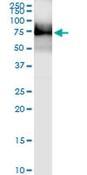 ALPL MaxPab rabbit polyclonal antibody (D01)