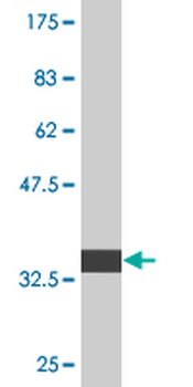 ALOX15B monoclonal antibody (M05), clone 4A7