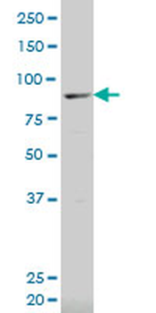 ALOX12B polyclonal antibody (A01)