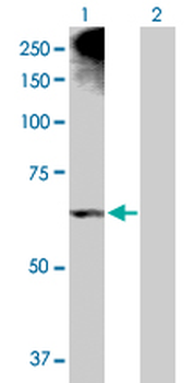 ALOX12 purified MaxPab rabbit polyclonal antibody (D01P)