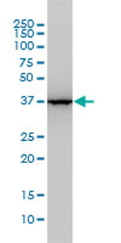 ALDOA monoclonal antibody (M02), clone 3C12-6D11