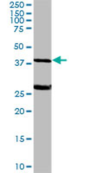 ALDOA purified MaxPab rabbit polyclonal antibody (D01P)