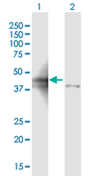 ALDOA purified MaxPab mouse polyclonal antibody (B02P)