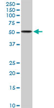 ALDH3A2 MaxPab rabbit polyclonal antibody (D01)