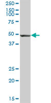ALDH3A2 purified MaxPab mouse polyclonal antibody (B01P)