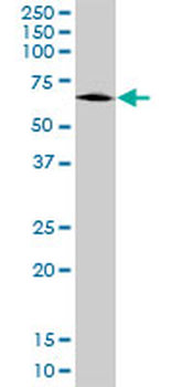 ALDH9A1 monoclonal antibody (M01), clone 3C6