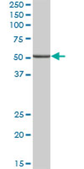 ALDH9A1 purified MaxPab mouse polyclonal antibody (B01P)