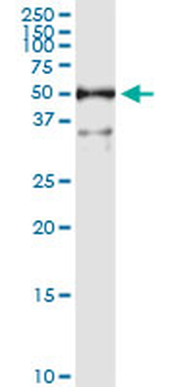 ALDH3A1 MaxPab rabbit polyclonal antibody (D01)