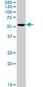 ALDH3A1 purified MaxPab mouse polyclonal antibody (B01P)