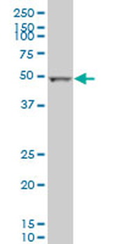 ALDH2 monoclonal antibody (M01), clone 1E5