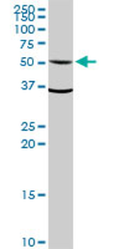 ALDH1A1 MaxPab rabbit polyclonal antibody (D01)