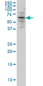 ALAS2 monoclonal antibody (M01), clone 6C1
