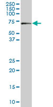 ALAS1 monoclonal antibody (M03), clone 2D5