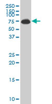 ALAS1 monoclonal antibody (M01), clone 3G10