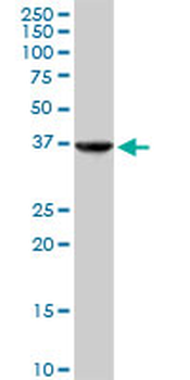 ALAD purified MaxPab rabbit polyclonal antibody (D01P)