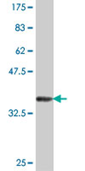 ALAD polyclonal antibody (A01)