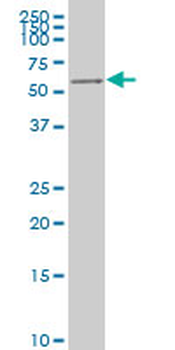 AKT2 monoclonal antibody (M05), clone 1F3