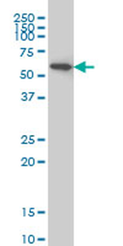 AKT1 monoclonal antibody (M09), clone 6F11