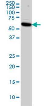 AKT1 monoclonal antibody (M03), clone 2E11