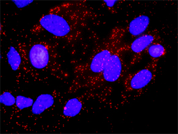 AKT1 purified MaxPab rabbit polyclonal antibody (D01P)
