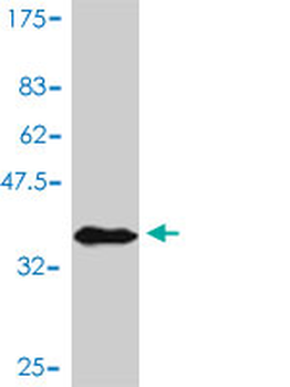 AKT1 polyclonal antibody (A01)
