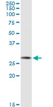 AK2 purified MaxPab rabbit polyclonal antibody (D01P)