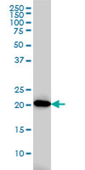 AK1 monoclonal antibody (M09), clone M2