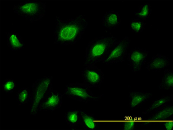 AK1 monoclonal antibody (M06), clone 3A6-1F5