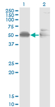 AHSG monoclonal antibody (M02), clone 1D8