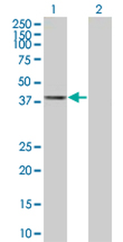 AHCY MaxPab mouse polyclonal antibody (B01)