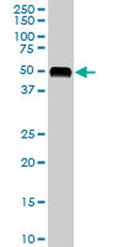 AGT monoclonal antibody (M01), clone 1A10