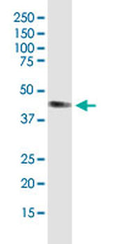 AGER monoclonal antibody (M02J), clone 1C1