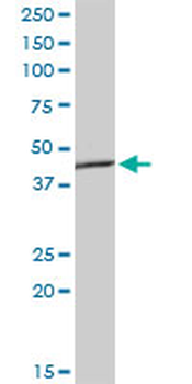 AGER monoclonal antibody (M02), clone 1C1