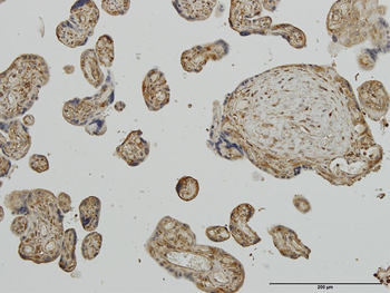 AP2B1 monoclonal antibody (M01J), clone 2D5