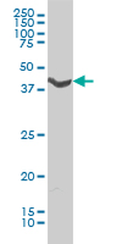ADRA1A monoclonal antibody (M01), clone 4C7