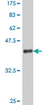PARP4 polyclonal antibody (A01)