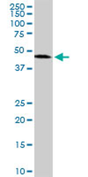 ADPRH monoclonal antibody (M04), clone 1F11