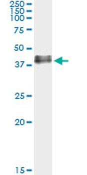 ADORA2A monoclonal antibody (M17), clone 4E4