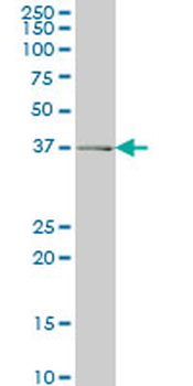 ADH6 monoclonal antibody (M01), clone 4G4