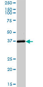ADH6 purified MaxPab mouse polyclonal antibody (B01P)