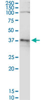 ADH5 monoclonal antibody (M12), clone 2D11