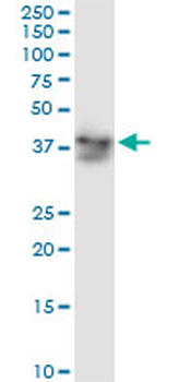 ADH5 monoclonal antibody (M01), clone 12F7