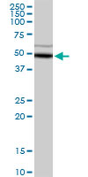 ADH5 purified MaxPab rabbit polyclonal antibody (D01P)